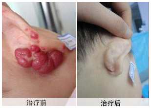 ѪǰͼƬ